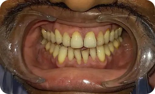 Smile Gallery