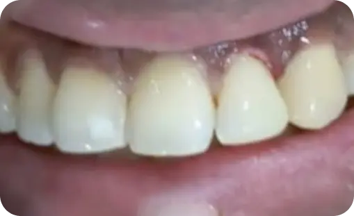 Smile Gallery