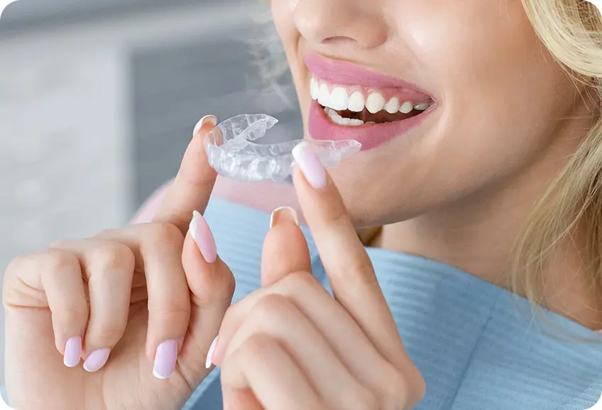 Aligners