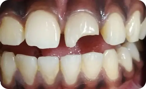 Smile Gallery
