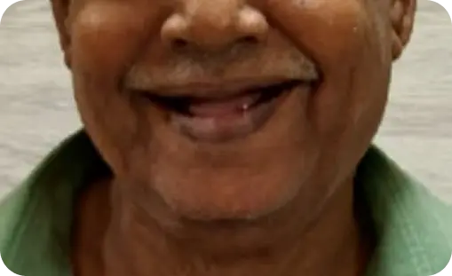 Smile Gallery