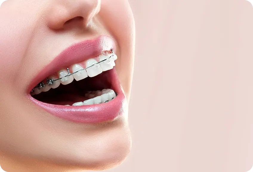 Orthodontics