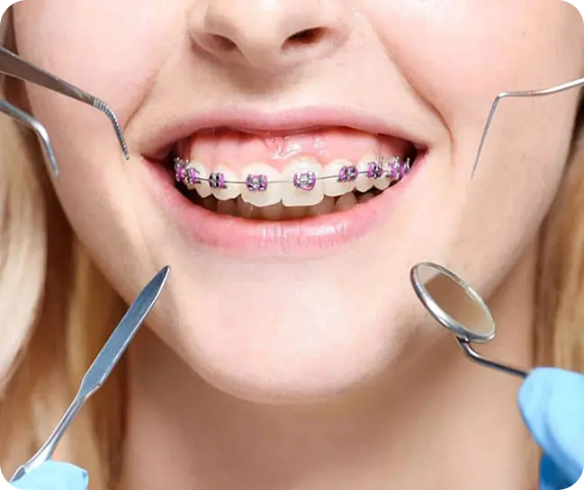 Orthodontics