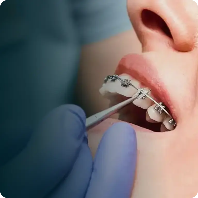 Orthodontics