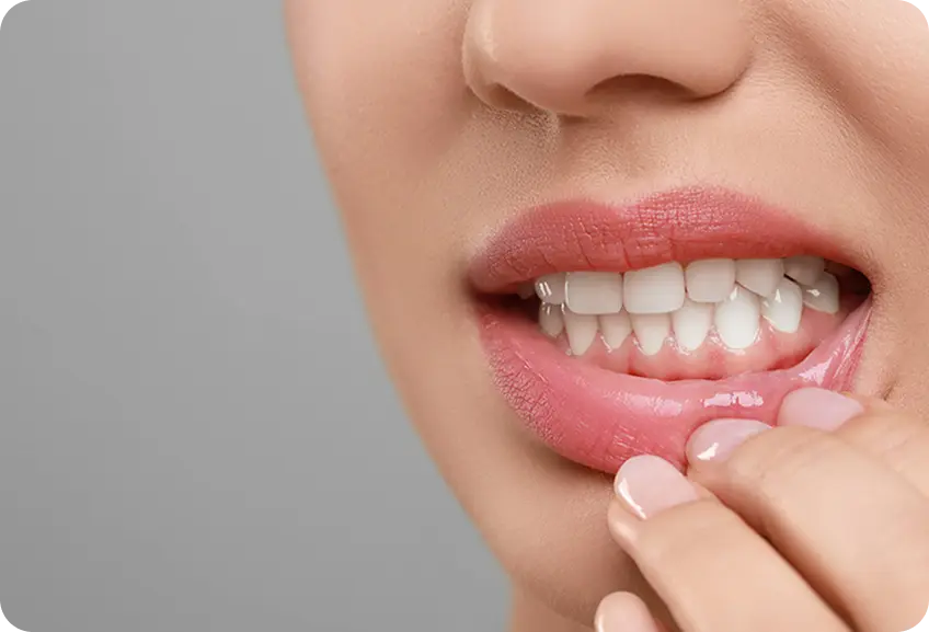 Periodontal Treatment