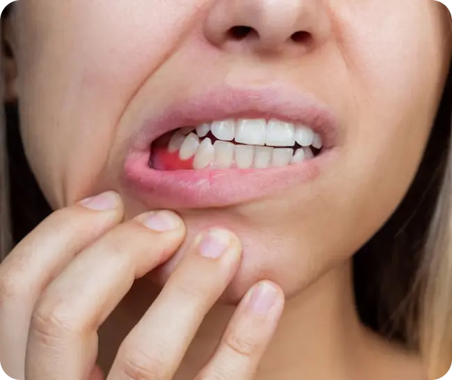 Periodontal Treatment