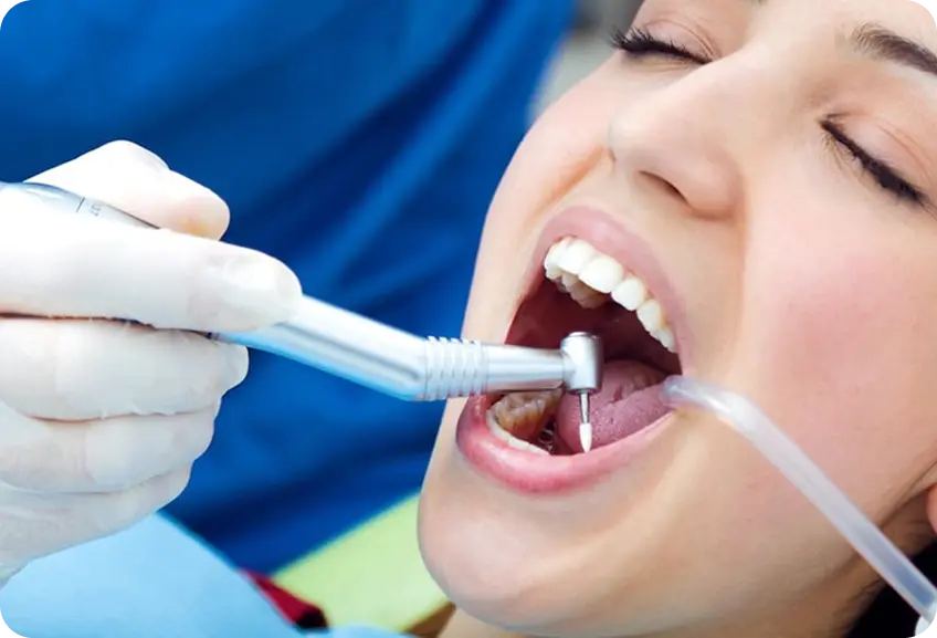 Root Canal Treatment