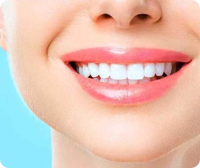 Smile Designing