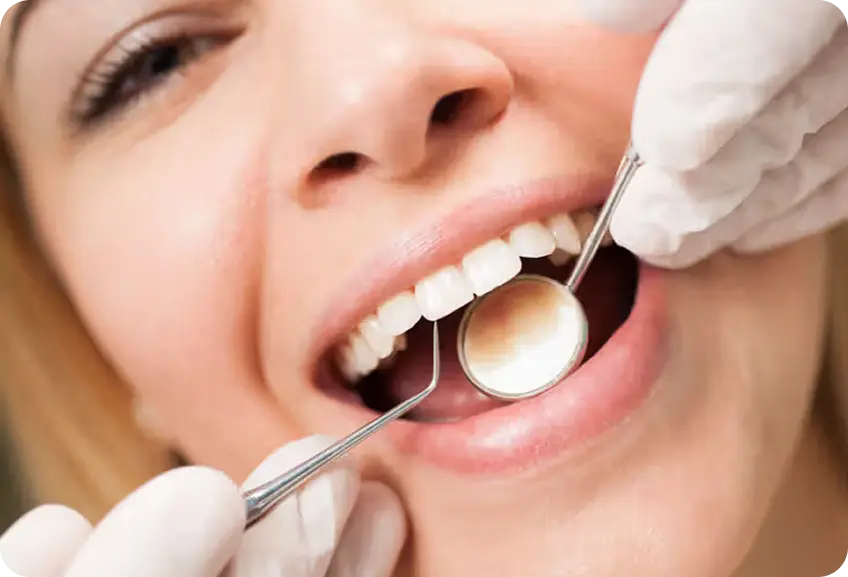 Teeth Cleaning