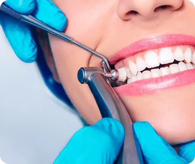Teeth Cleaning